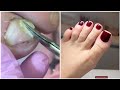 Most Satisfying Pedicure Transformation 😱 best nail polish for toes 2024
