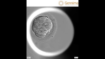 Amazing embryo development seen with EmbryoScope+, Gennima IVF