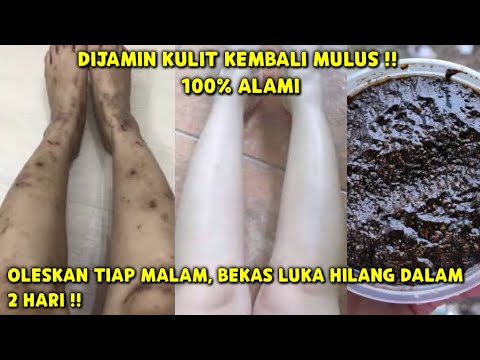 Video: Cara Mengeluarkan Bekas