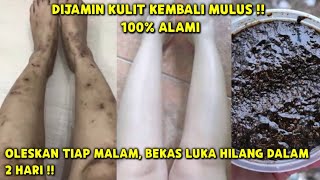 HOW TO REMOVE SCARS ON FEET & HANDS (SCABGS) QUICKLY AND NATURALLY #wulanhusna