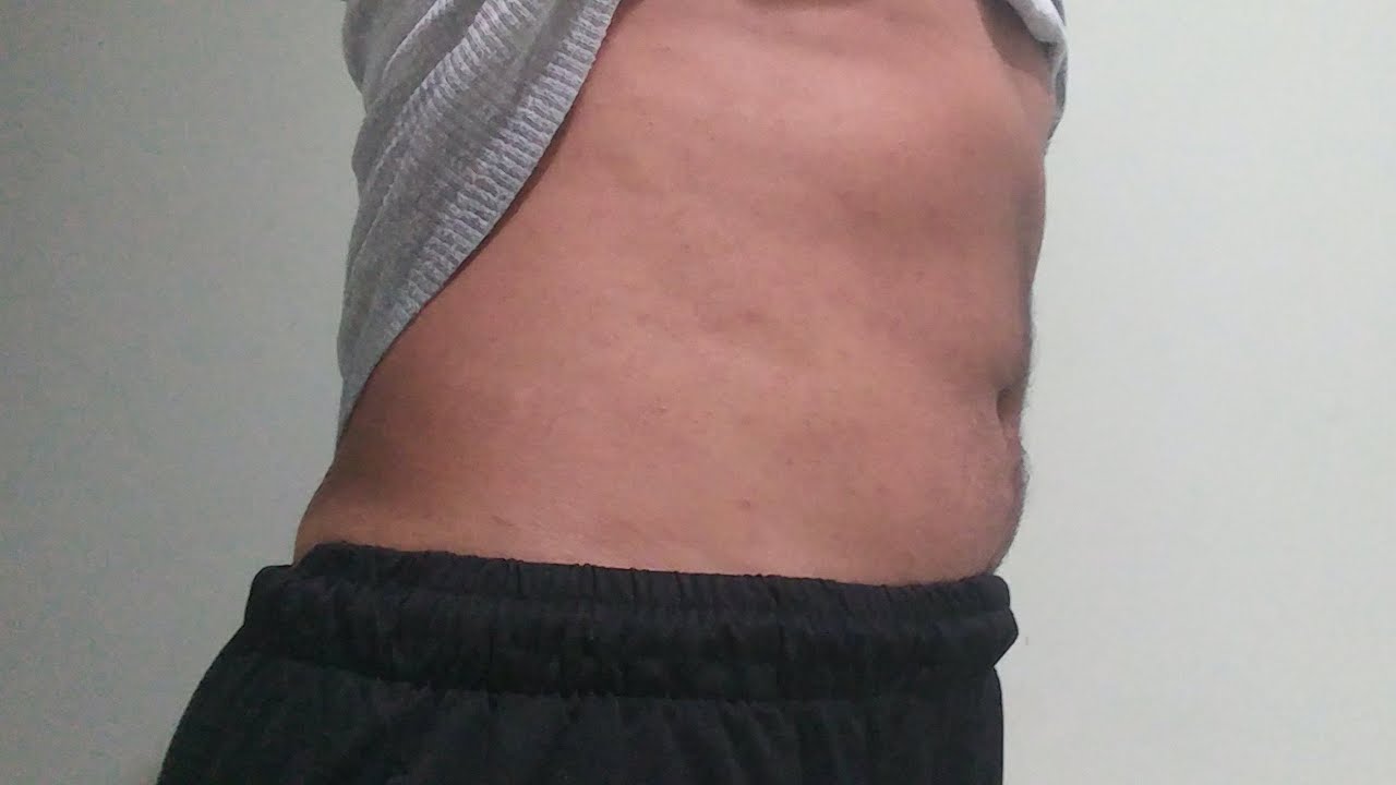 Amazing Belly Fat Loss 30 Days On TRT YouTube