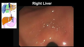 A station-wise approach to liver anatomy for linear EUS