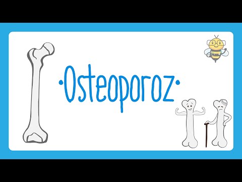 Osteoporoz (Kemik Erimesi) Nedir? | Osteoporoz Hakkında Bilmeniz Gerekenler