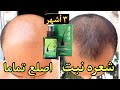   - لوشن علاج الصلع و تساقط الشعر رقم واحد في العالم العربي - يعادل المينوكسيديل