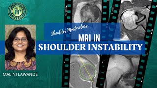 MRI IN SHOULDER INSTABILITY | MALINI LAWANDE | Hill Sachs | Bankart | Labral Tear | ALPSA | HAGL