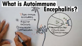 Autoimmune Encephalitis | What is Autoimmune Encephalitis