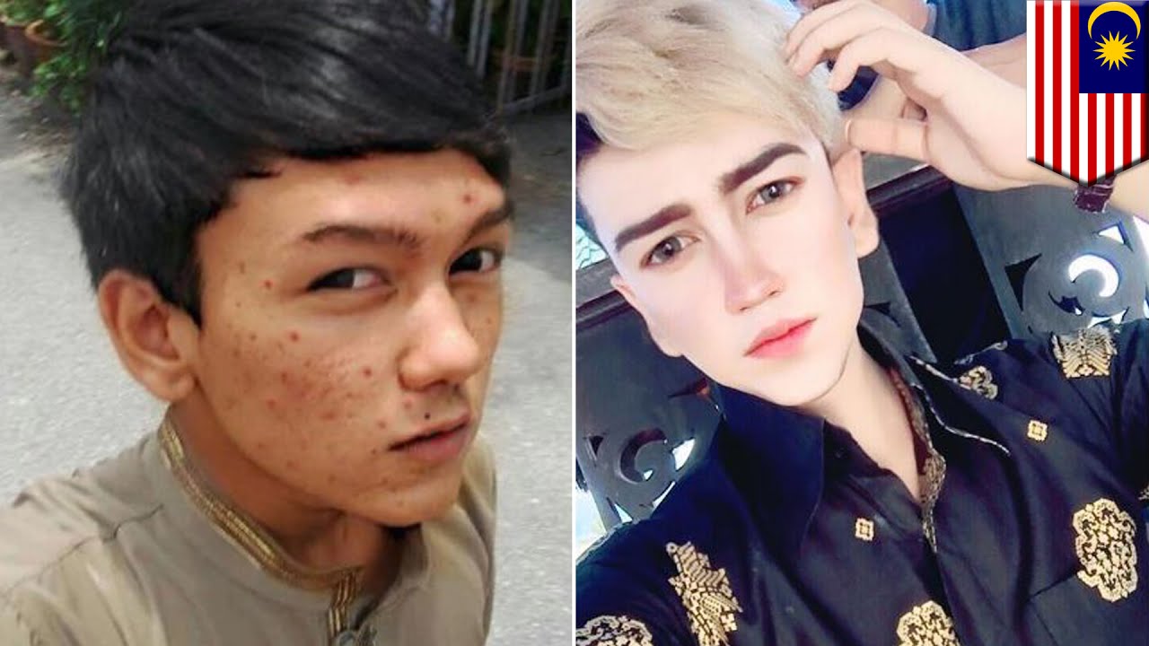 Pemuda Operasi Plastik Wajah Terinspirasi Dari Game Final Fantasy