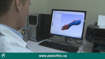 How Orthotics Are Made - Getting the Perfect Fit