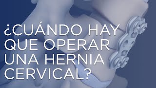 ¿Cuándo hay que operar una hernia cervical?