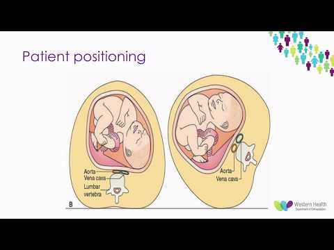 Orthopaedic Trauma in Pregnant Patients by Dr Adrian Talia