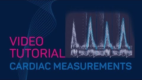 MV Tissue E/È Video Tutorial #TTA2.30