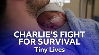 Baby Charlie's Fight For Survival | Tiny Lives | BBC Scotland