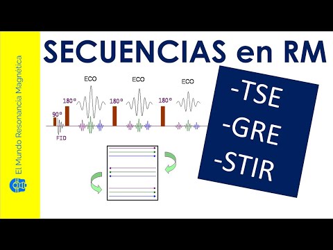 Vídeo: Què és una ressonància magnètica en gradient?