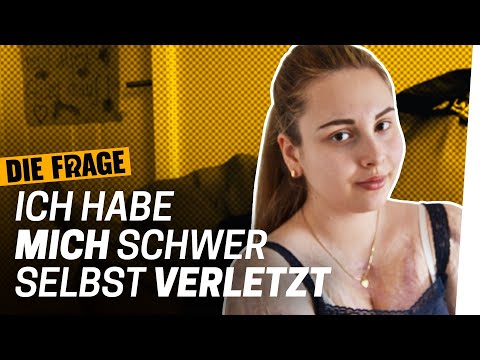 Video: 3 Möglichkeiten, Fragen zu selbstverletzenden Narben zu beantworten