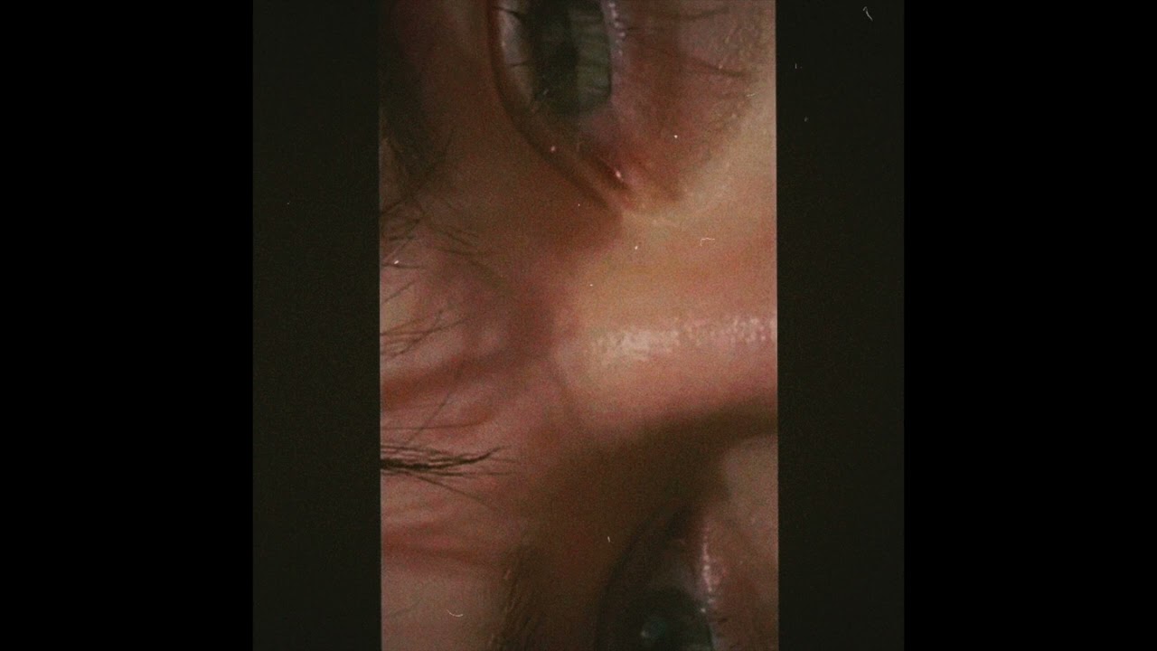 [FREE] Lomepal Type Beat "Cassidy" (Prod. IVERRN)