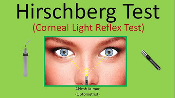 Hirschberg Test | Corneal Light Reflex Test | CLR | HBRT