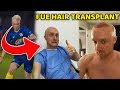 I Had a Hair Transplant! (FUE HAIR TRANSPLANT)