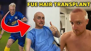 I Had a Hair Transplant! (FUE HAIR TRANSPLANT)