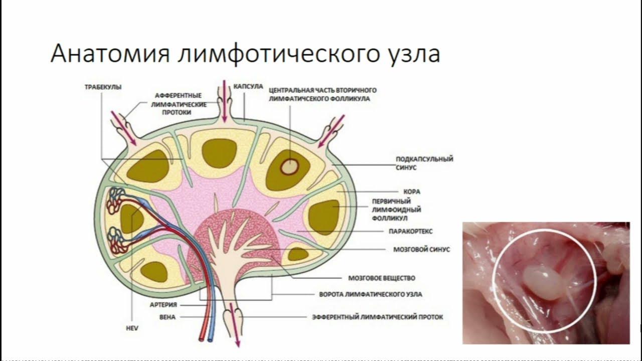 Аксиллярная лимфаденопатия молочной