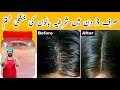 Remove Hair Dandruff Permanently In 3 Days | How to Get Rid of Dandruff Homemade oil | BaBa Food RRC