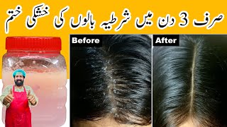 Remove Hair Dandruff Permanently In 3 Days | How to Get Rid of Dandruff Homemade oil | BaBa Food RRC screenshot 2