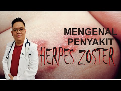 Video: Apakah Garis Craze Itu? Penyebab, Pengobatan & Pencegahan