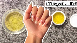 Grow Your Nails In Just 10 Days! (Guaranteed) | Exploring Beauty