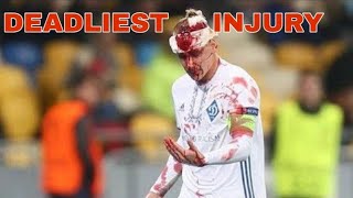 The most DEADLIEST head injury in football [Domagoj Vida ] screenshot 1