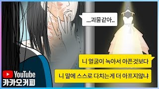 얼굴에 3도화상을 입은 예비신부에게 신랑이 한 행동 (감동실화)