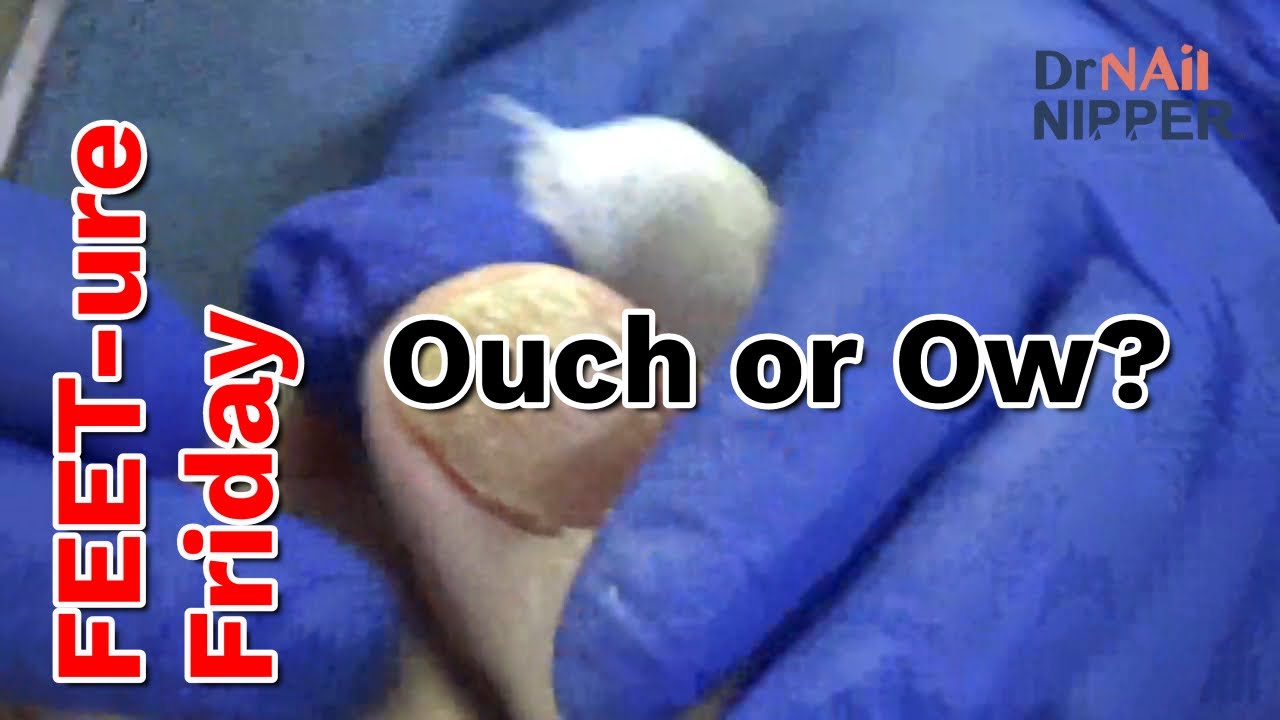 Patient Says Ow Or Ouch Rhymes With Couch 2023 YouTube