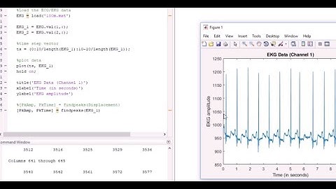 How to code a simple heart beat detector (in Matlab)