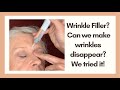 Dermaflage Wrinkle Filler. Can It Make Wrinkles Disappear? My Mom Tries It!