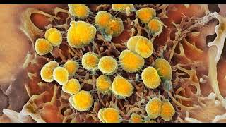 Fda Approves New Antibiotics To Combat Rising Gonorrhea Cases