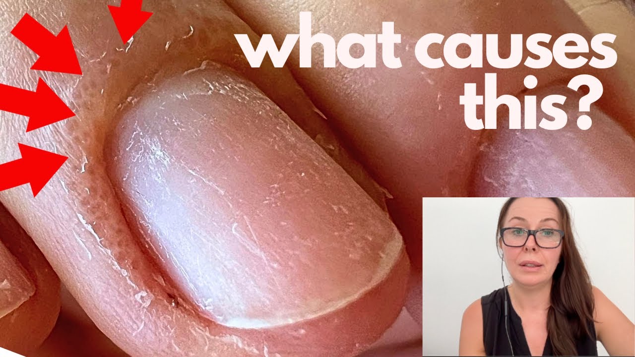 Nail technician left me in so much pain | Mumsnet