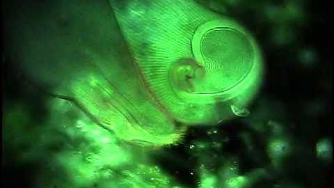 Stentor Coeruleus: Captured Using CytoViva Enhanced Darkfield Microscopy System