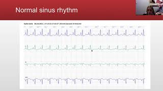 Dr  Rodriguez ECG Rounds, session 1