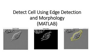Detect Cell Using Edge Detection and Morphology screenshot 5