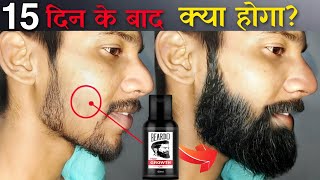 Beardo Hair Growth Oil After 15 Days Review | Best Beard Oil For Patchy Beard in India 2024