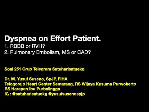 Video: Elastisitas Aorta Setelah Bantuan Koarktasio Aorta: Perbandingan Terapi Bedah Dan Intervensi Dengan Pencitraan Resonansi Magnetik Kardiovaskular