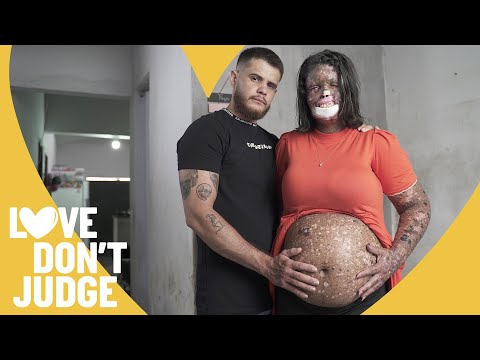I Thought I'd Never Find Love - Now I'm Pregnant | LOVE DON'T JUDGE