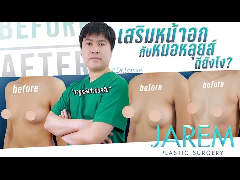 รีวิวทำนม เสริมหน้าอกสวยพอดีตัว หมอหลุยส์จัดให้