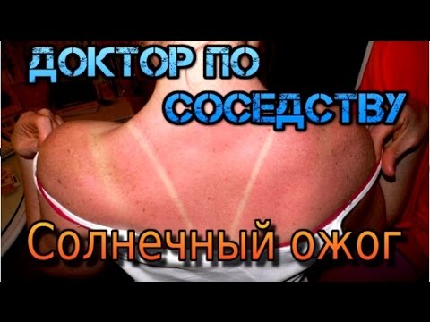 Как лечить солнечный ожог / How to treat sunburn