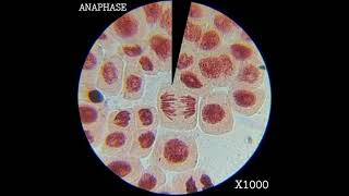 ONION ROOT TIP CELL DIVISION STAGES (MAGNIFICATION : X1000)