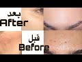 My skin care routine |How I cleared my skinروتين العنايه بالبشرة + الترتيب الصحيح الخطوات | رغد حمزة