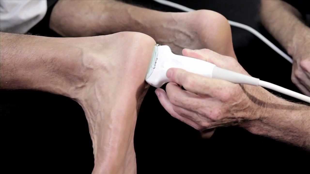 How to Scan the Knee and Foot with Ultrasound