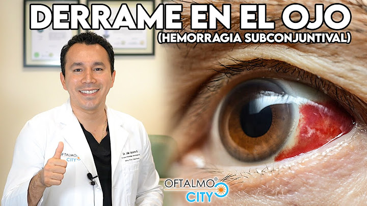 Derrame - Sangrado  en el OJO 👁 ¿Por qué aparece y cómo se quita?