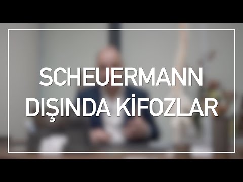 Scheuermann Hastalığı Dışındaki Yapısal Kifozlar Nelerdir?
