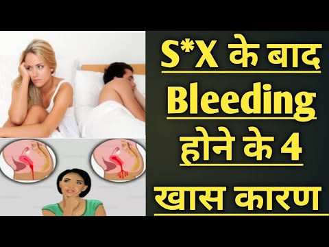 सेक्स के बाद Spoting होने के क्या कारण होते है || Four Big Reasons Of Spoting After  Sex ||