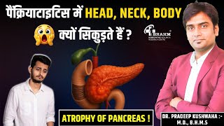 Pancreas Swelling Treatment In Hindi | Atrophy Of Pancreas Ka Ilaj | अग्नाशय में सूजन का इलाज