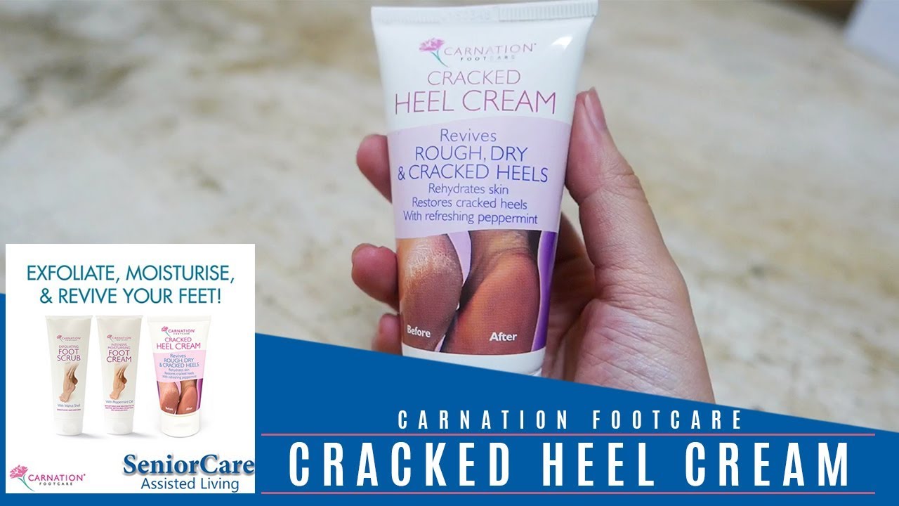 Ember Foot Cream For Rough, Dry and Cracked Heel, Feet Cream For Heel  Repair - Price History